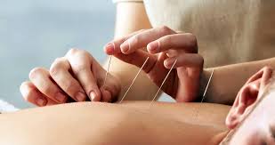 Key Acupuncture Points for Weight Loss and Appetite Control