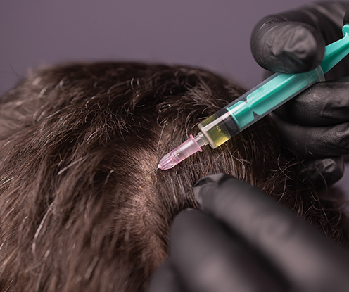 PRP (GFC & QR 678) in Bangalore – The Rising Demand & Why You Should Include This Training