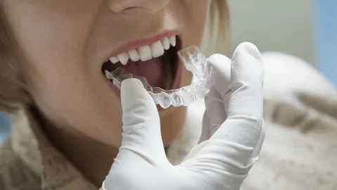 Transform Your Smile with Clear Aligners and Expert Family Dental Care in Ahmedabad