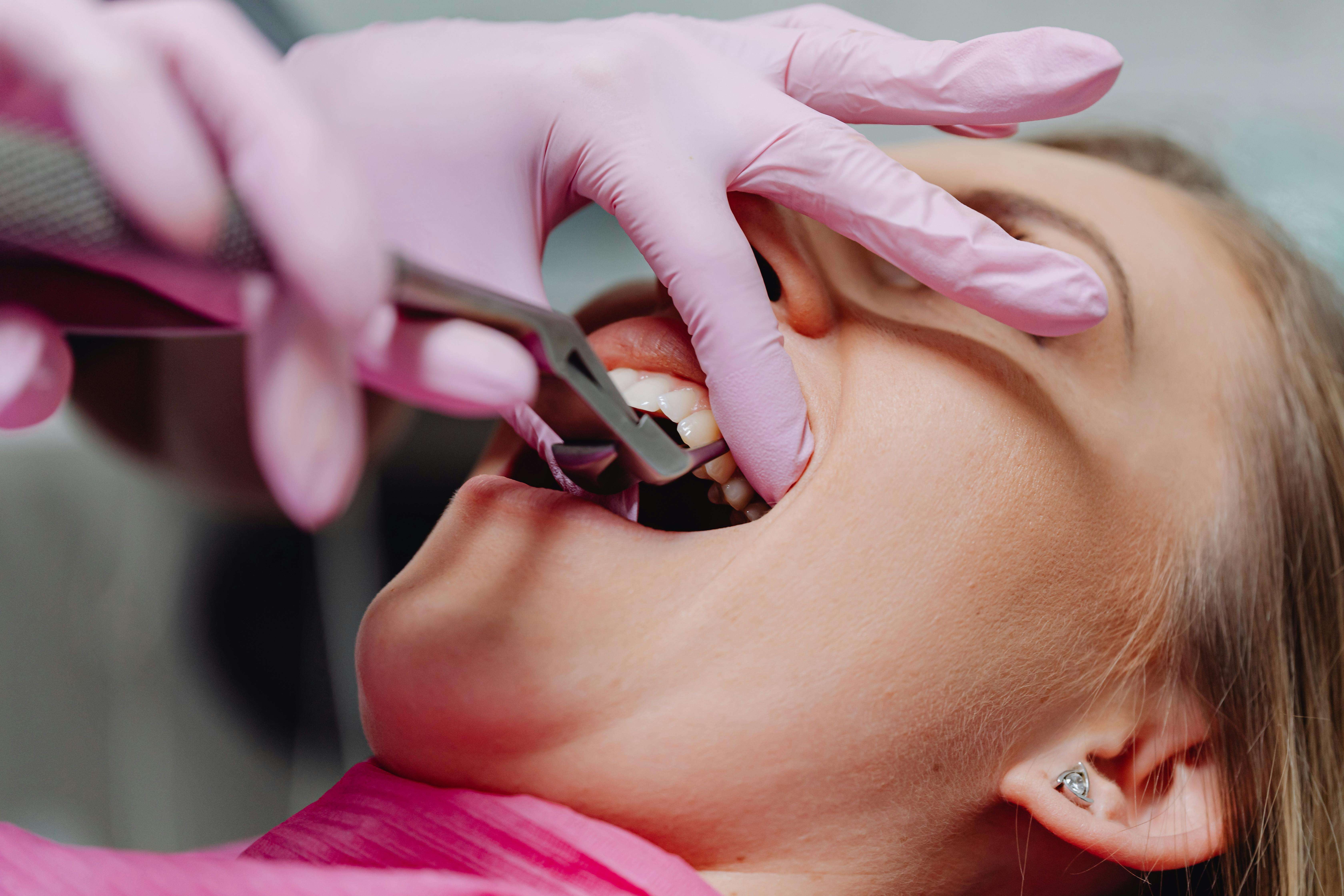 Invisalign Parramatta – A Modern, Discreet Way to Straighten Your Smile