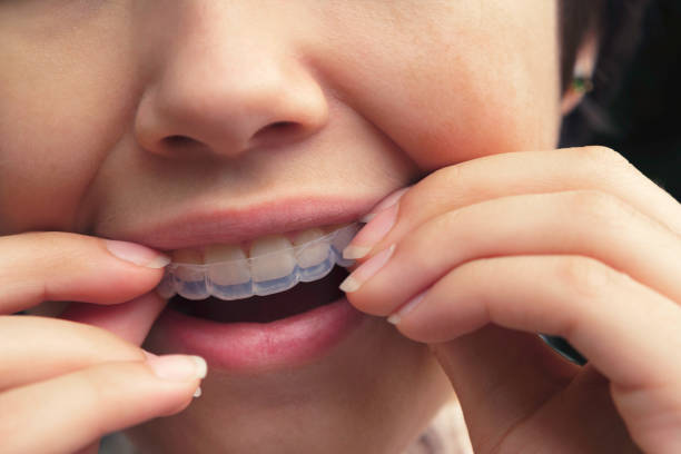 Crooked Teeth? How Invisalign Can Fix Your Smile Without Braces