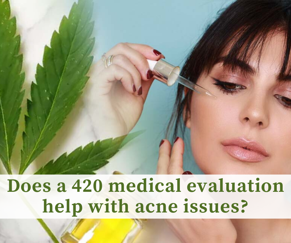 Does a 420 medical evaluation help with acne issues?