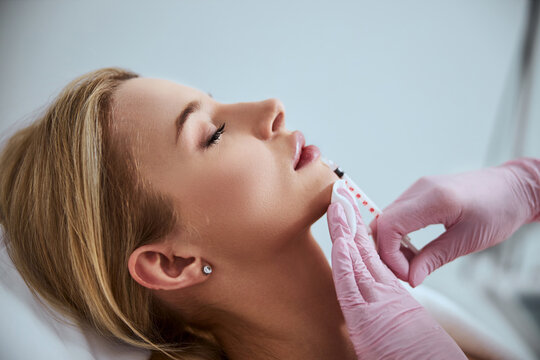 Discover the Benefits of Dermal Fillers in Regina