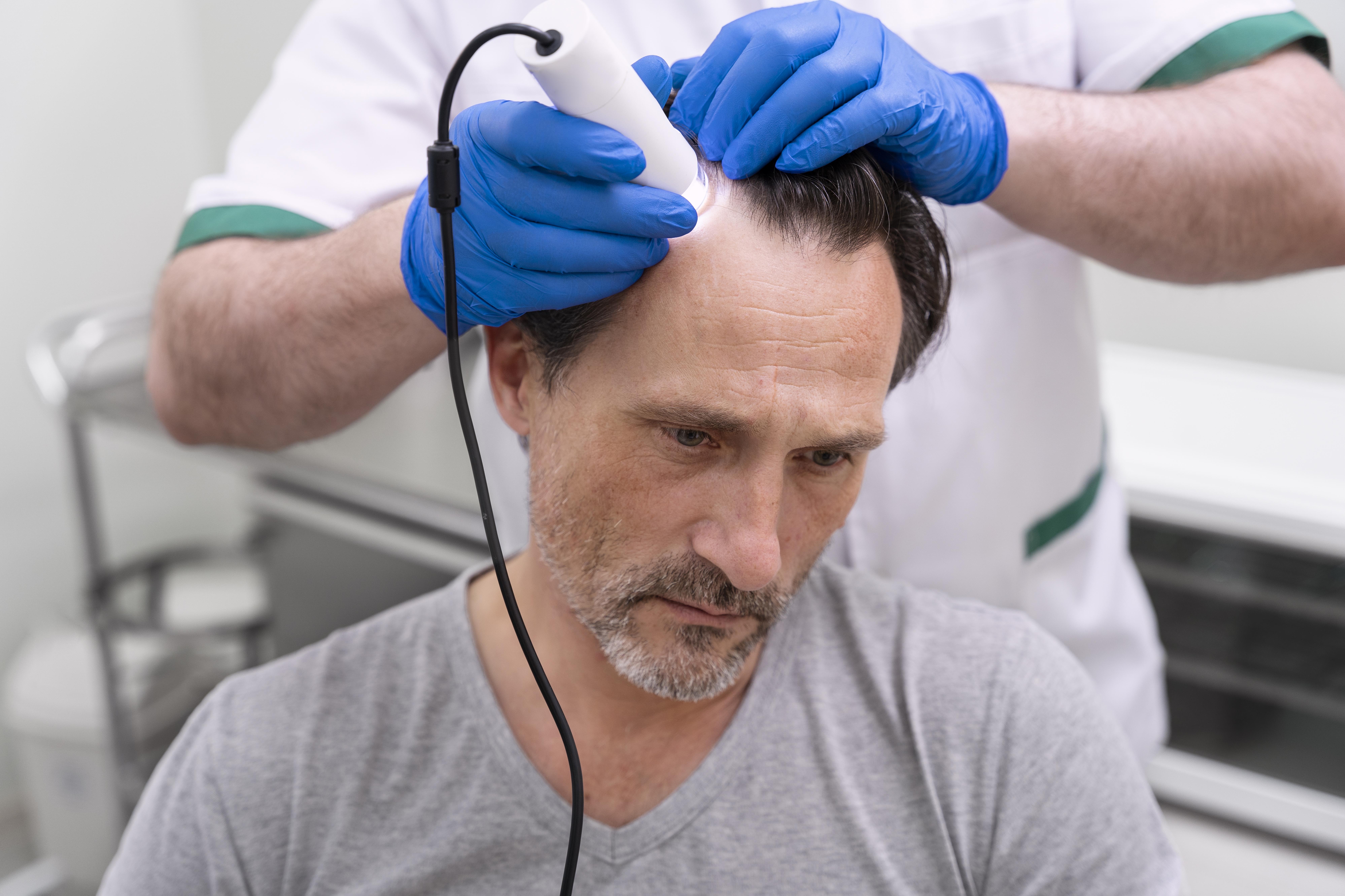 Hair Transplant Explained: What It Is & How It Works