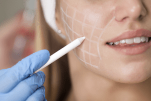 Why Women Prefer Dermal Fillers in Dubai for Natural Results
