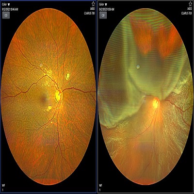 How to Find the Best Retina Doctor for Your Vision Care
