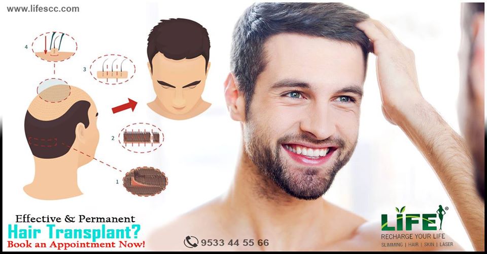 Best Hair Transplantation treatment In Hyderabad