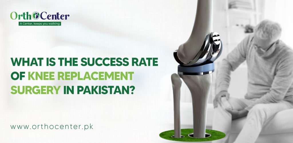 Breaking Down Knee Replacement Costs in Pakistan: What Patients Should Consider