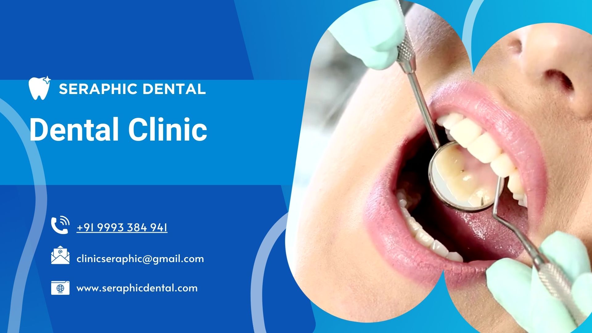 A Guide to Getting Zirconia Caps in Indore