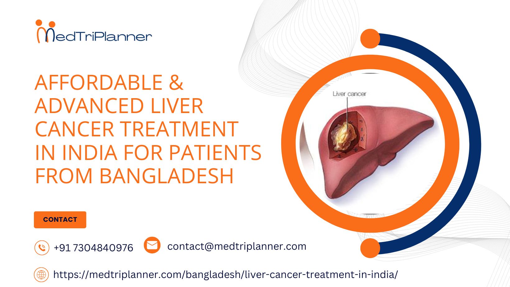 Affordable & Advanced Liver Cancer Treatment in India for Patients from Bangladesh
