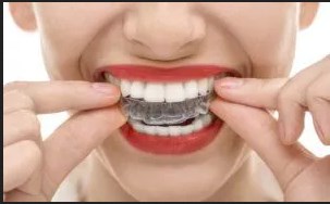 Partial Denture - Practical Advice for Denture Wearers