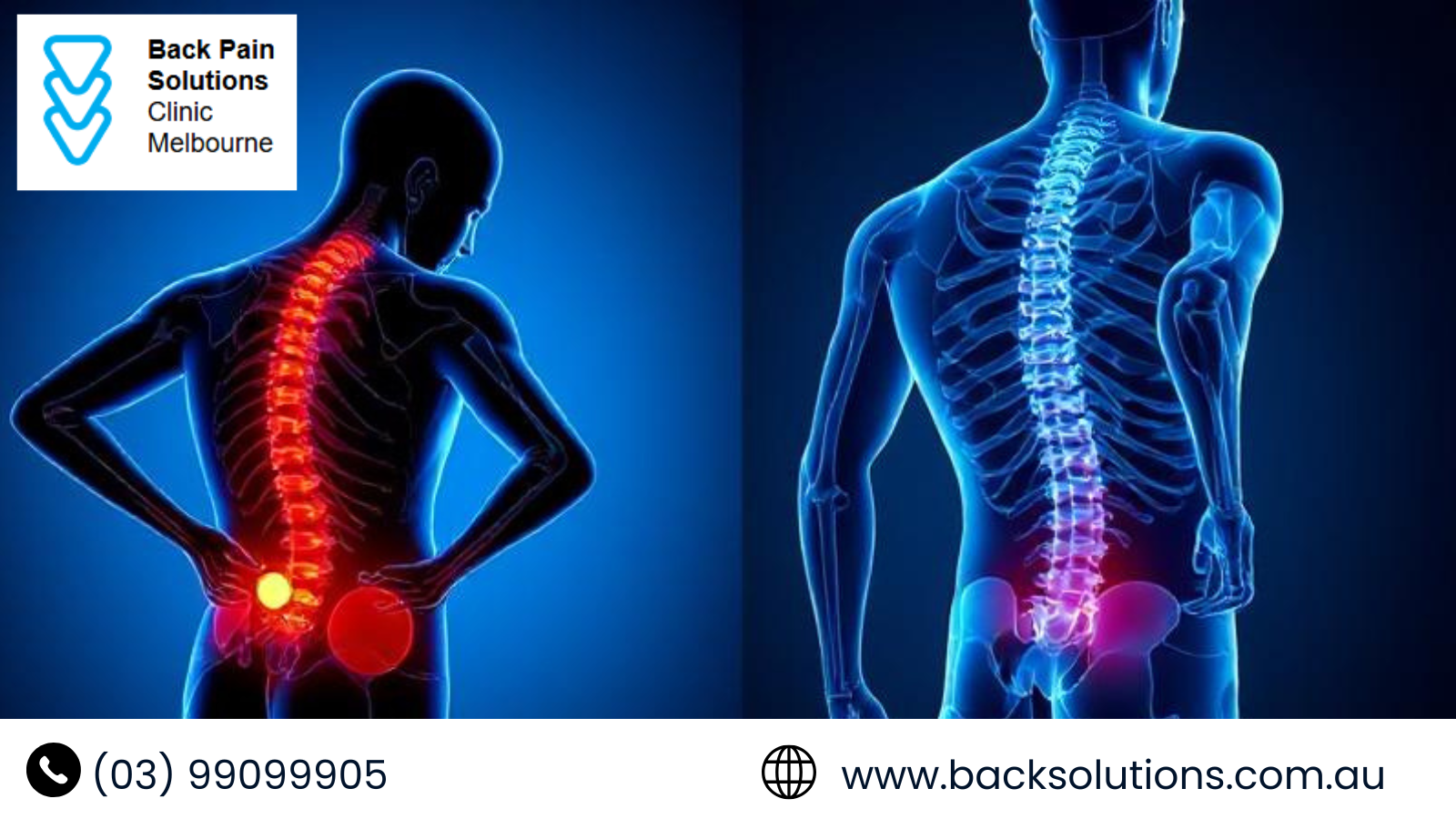 How to Manage Disc Pain Without Painkillers – Natural Solutions in Melbourne