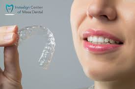 Best Cosmetic Dentistry That Offers Most Affordable Invisalign Membership Plan