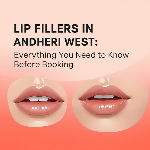 Lip Fillers in Andheri West: Everything You Need to Know Before Booking
