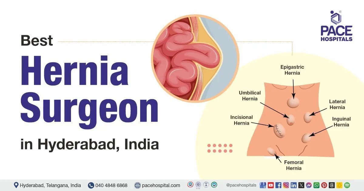 Best Hernia Doctors in Hyderabad, India