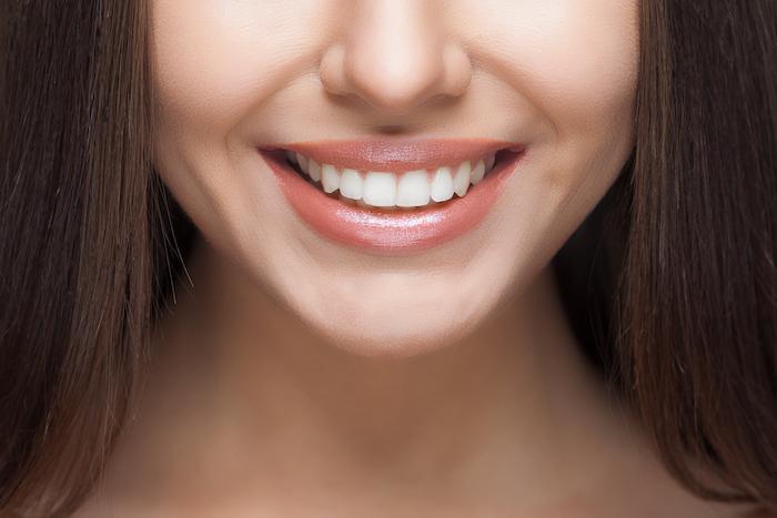 How Dental Veneers Can Transform Your Smile