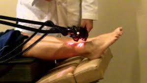 Global Neuropathy Pain Treatment Market Report 2020 Forecast to 2025