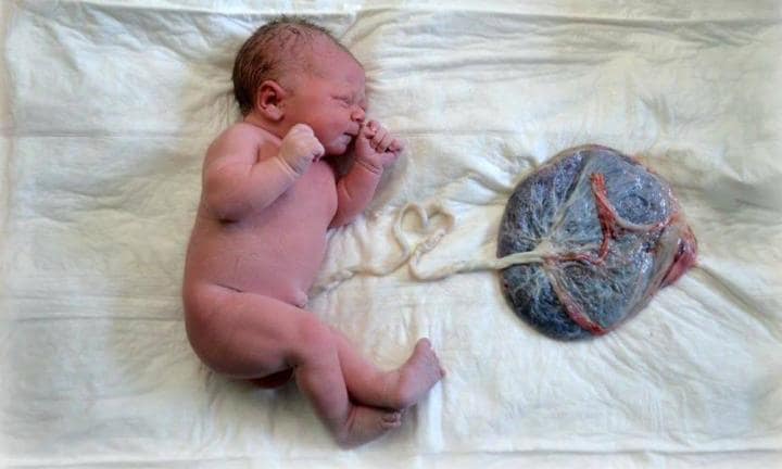 Placenta Market 2019 Global Industry Growth, Size, Demand, Trends, Insights and Forecast 2026| Esticast Research