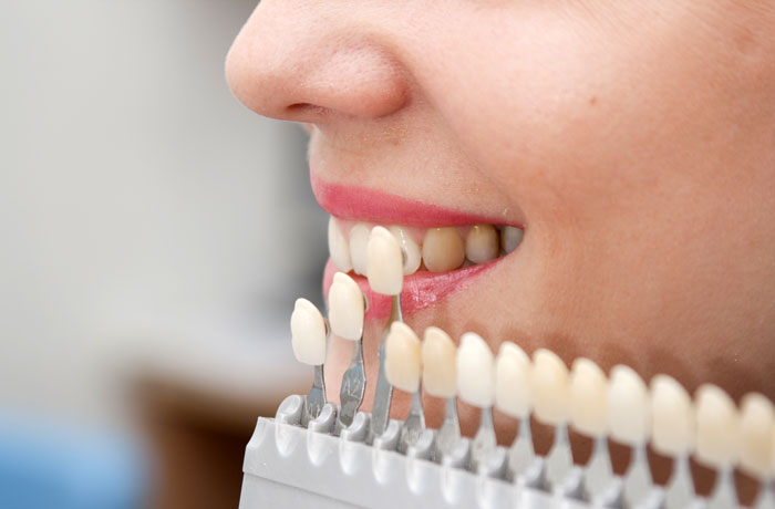 Best Dental Clinic in Rajgarh
