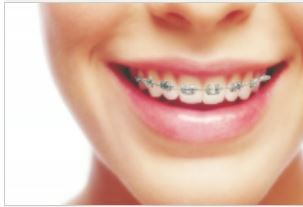 Best Dental Clinic in Rajgarh