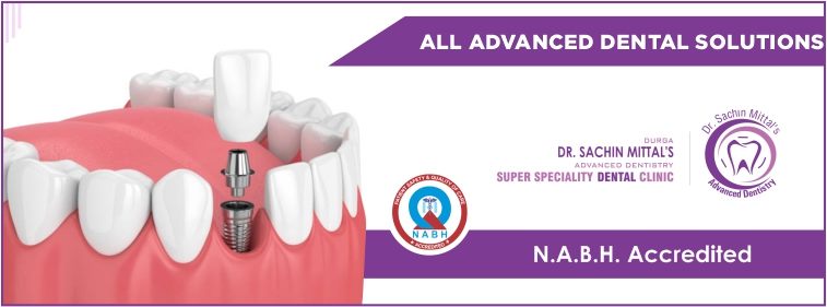 Why Dental Implant in Hisar is the Top Dental Clinic in Haryana?