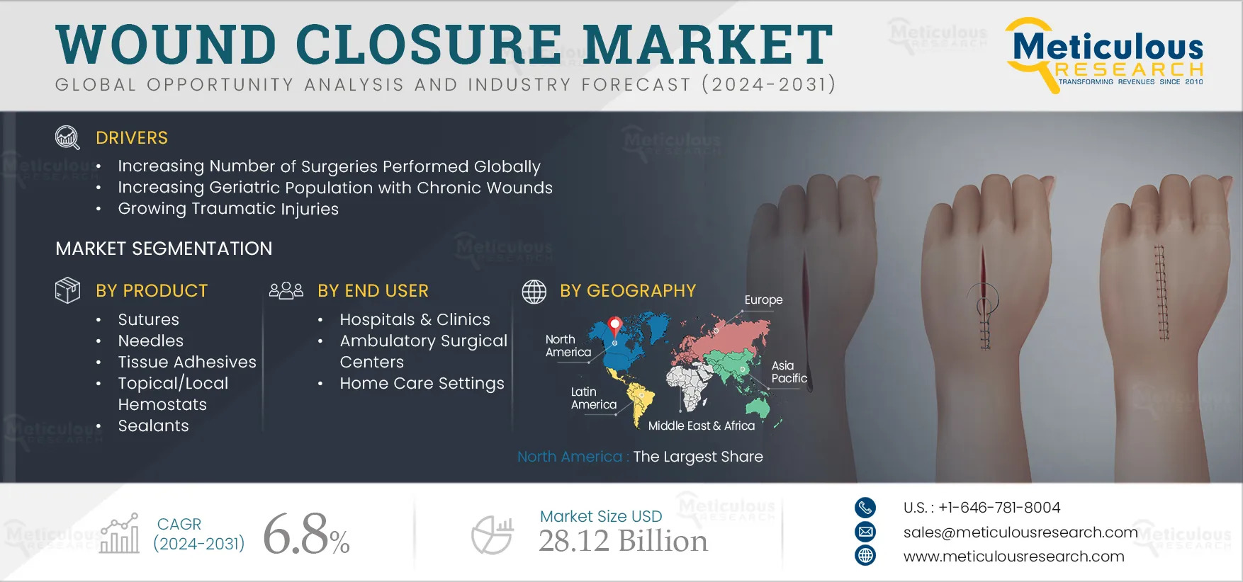 Global Wound Closure Market to 2032 – Key Drivers, Challenges & Opportunities