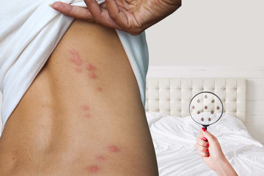 Bed bug treatment, elimination and control services in Houston Texas