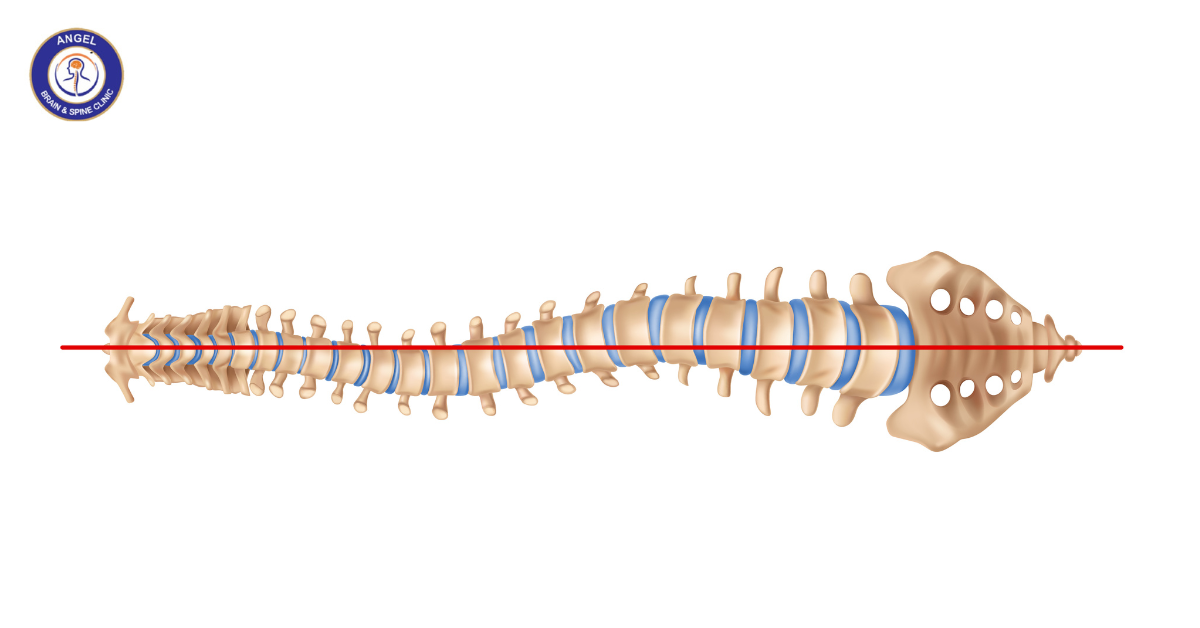 Spine Surgery Outcomes: Success Rates and Recovery Tips