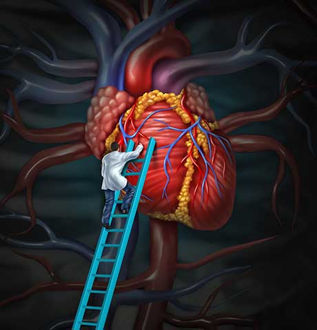 Best Cardiac Surgery in India