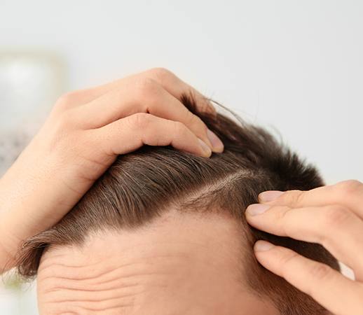 Restoring Confidence and Care – Advanced Skin, Hair & Laser Treatments in Dandenong