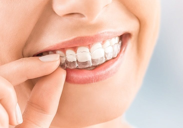 Orthodontics Santa Ana