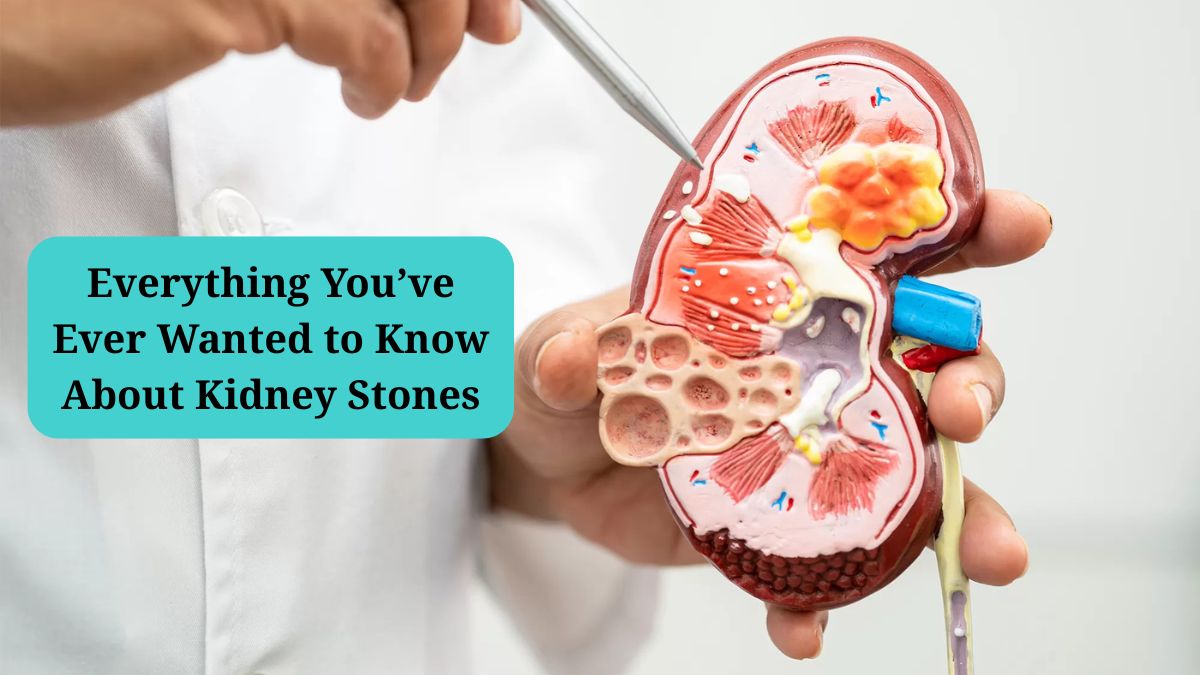 Everything You’ve Ever Wanted to Know About Kidney Stones
