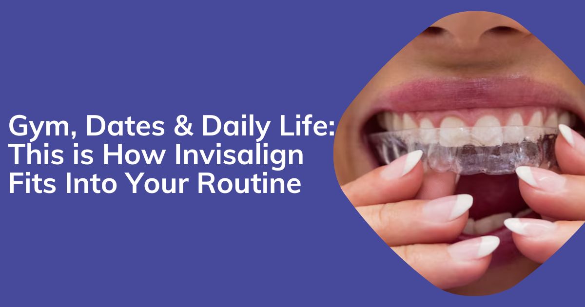 How Invisalign Treatment Fits Into Your Daily Routine