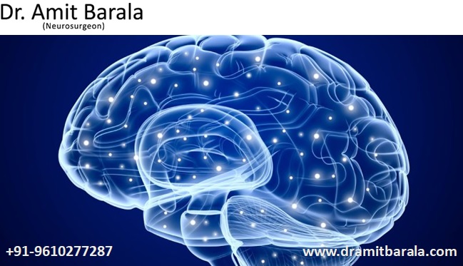 Best Neurosurgeon Doctor in Jaipur