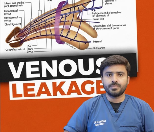 Venous leak Treatment