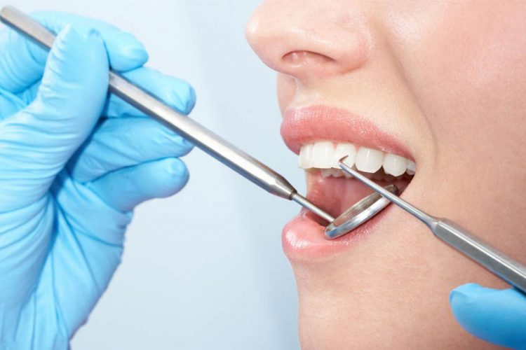 The Best Guide to Dental Implants