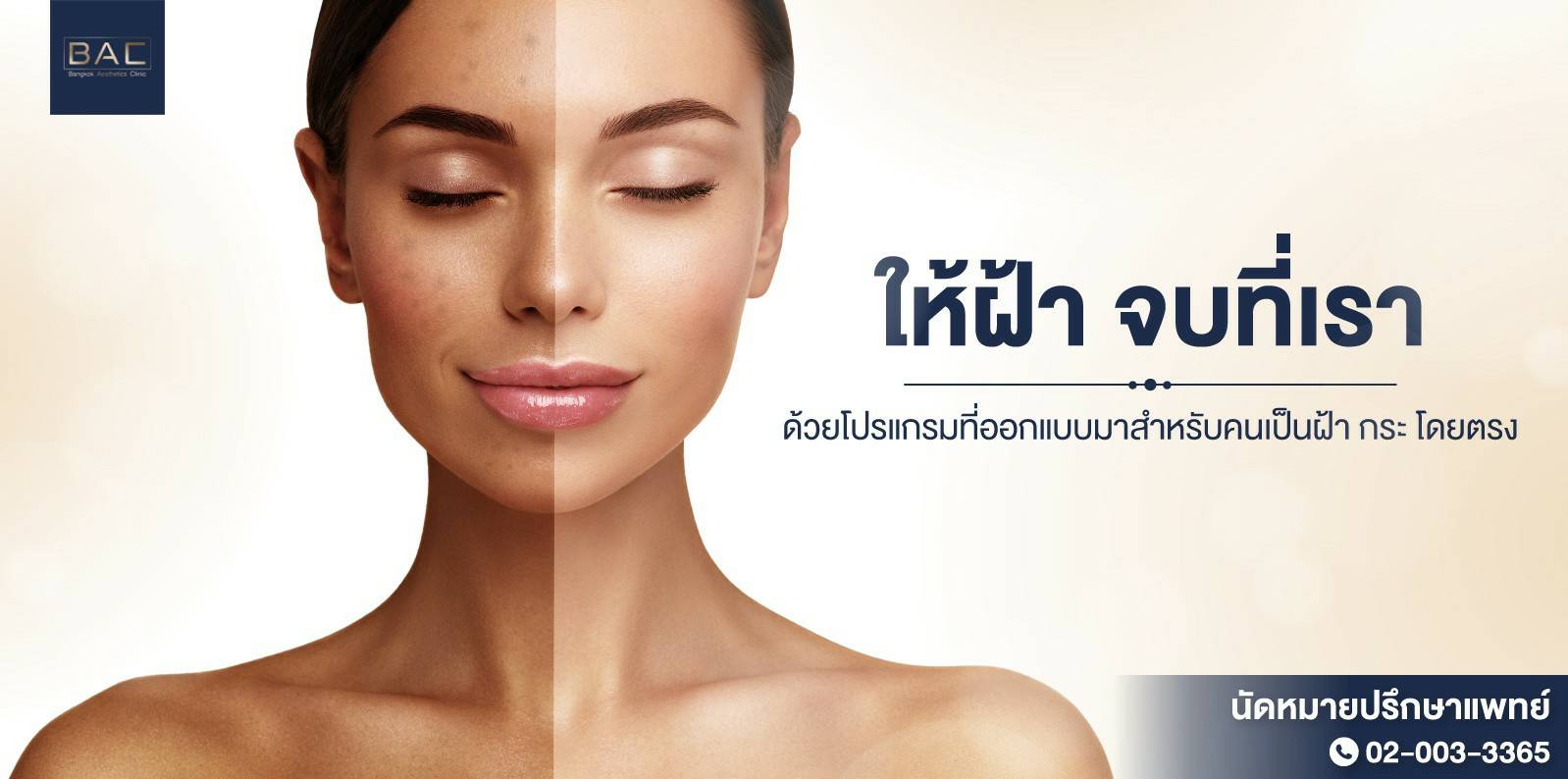 รักษาฝ้าที่ไหนดี | เลเซอร์ฝ้า BAC Clinic ปลอดภัย เห็นผลจริง