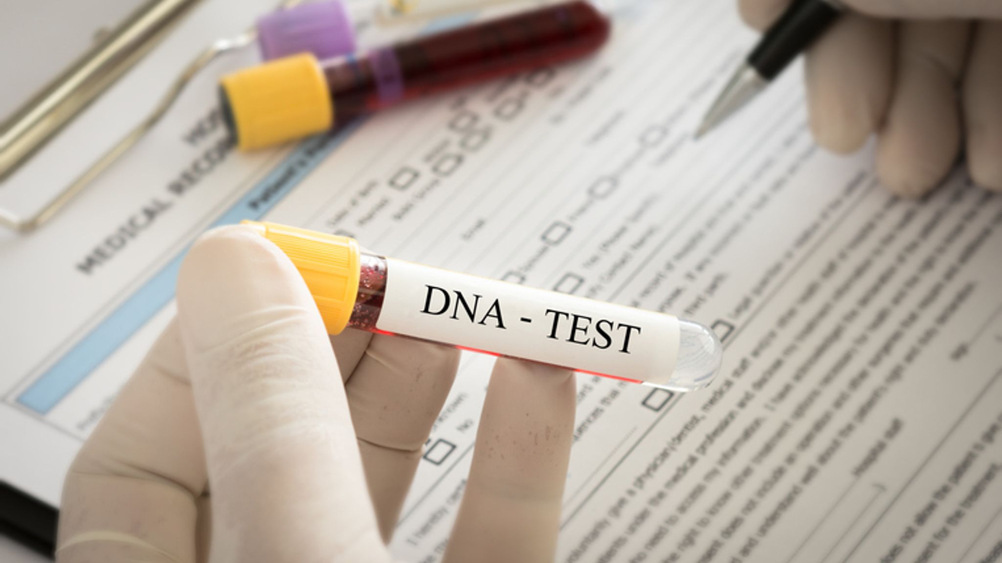 DNA Test and Personalized Health: What’s the Connection?