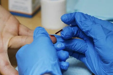 Chlamydia Test Preparation: What to Do Before Testing