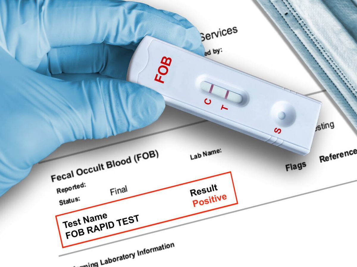 Trichomoniasis Test: Common Myths and Facts