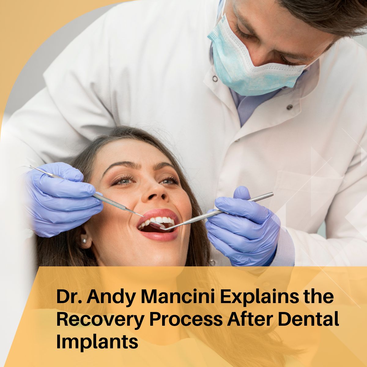 Dr. Andy Mancini Explains the Recovery Process After Dental Implants
