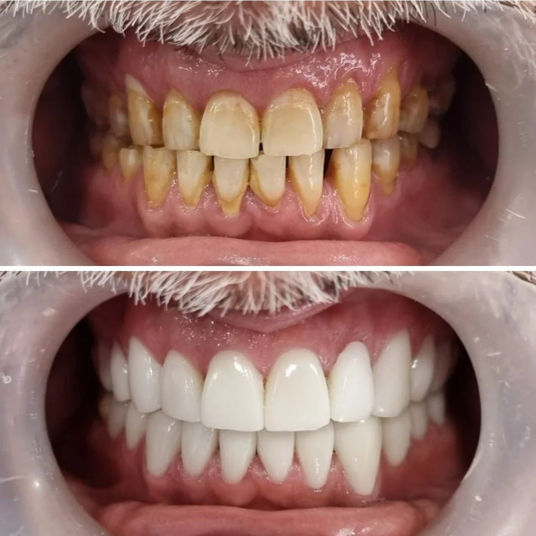 Leaders in dental treatments for complex cases