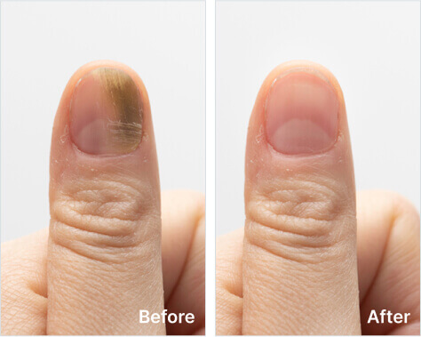 RevaNail™ Reviews: Real Users Share Their Nail Transformation Stories