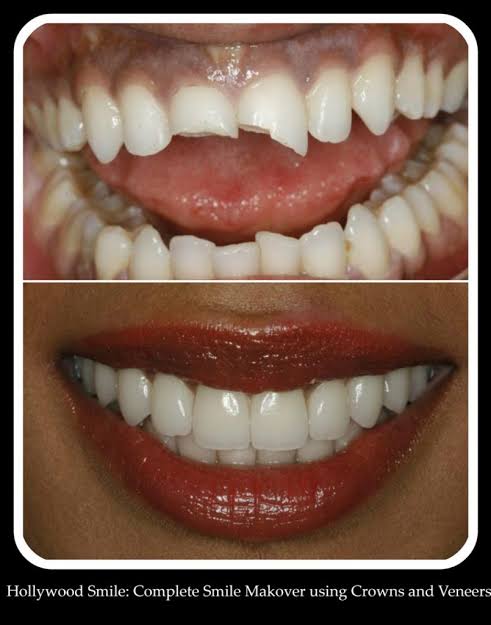 top dental clinics in dubai