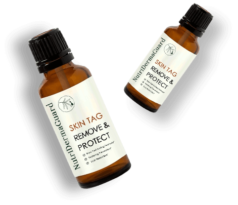 NutriDermaGuard Skin Tag Remover Reviews – Worth it?