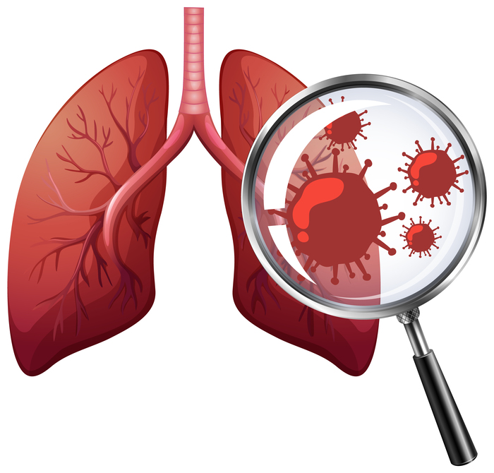 Why India Is Becoming a Global Hub for Affordable Lung Cancer Care