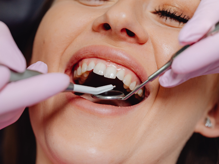 Is Root Canal Treatment Painful? Myths vs Facts