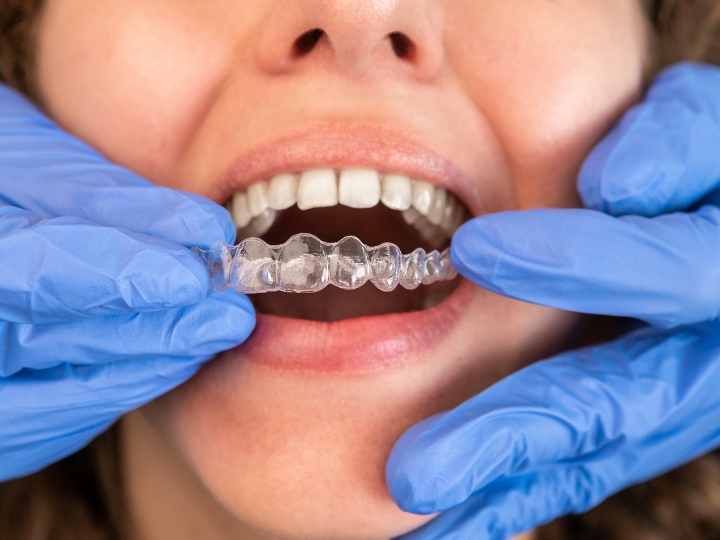 How Clear Planning Helps Manage Orthodontist Cost for Braces