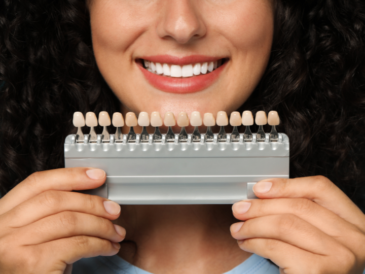 Dental Veneers vs. Teeth Whitening: Which is Better?