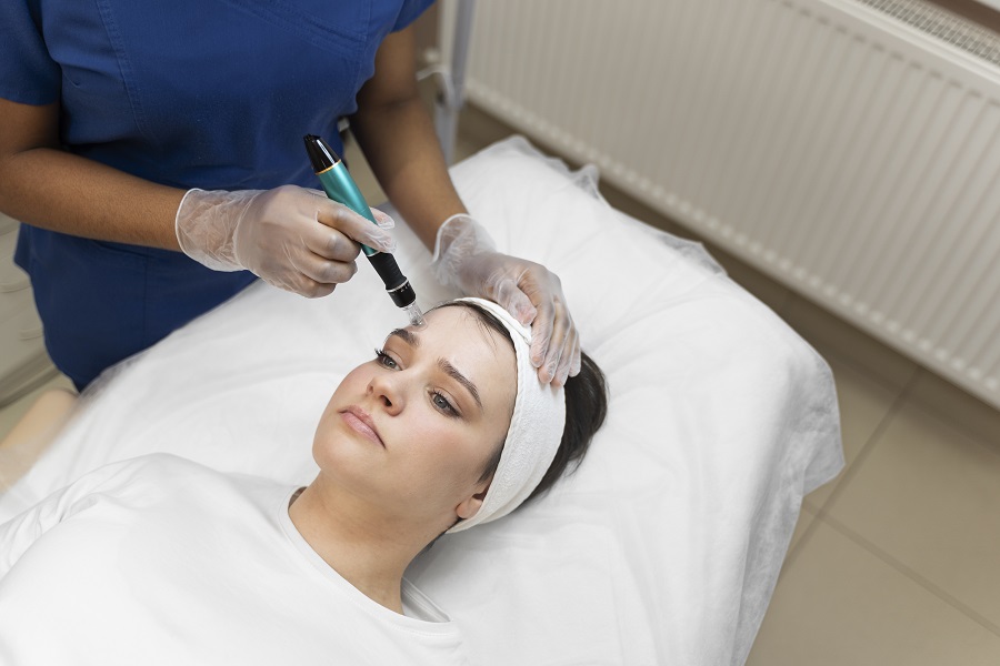 How to Rebuild Collagen and Volume with Sculptra and RF Microneedling